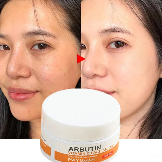 Vitamin C Whitening Freckle Face Cream