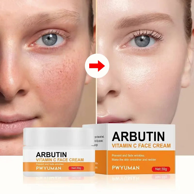 Vitamin C Whitening Freckle Face Cream